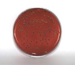 EMB Levine Agar (Eosin Methylene Blue). Placa de contato RODAC ™. 
